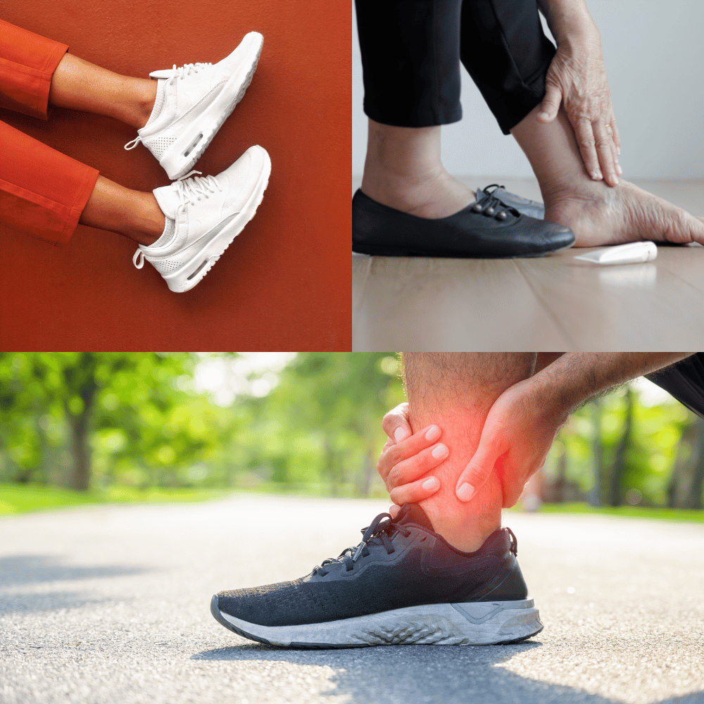 The Best Shoes For Swollen Feet