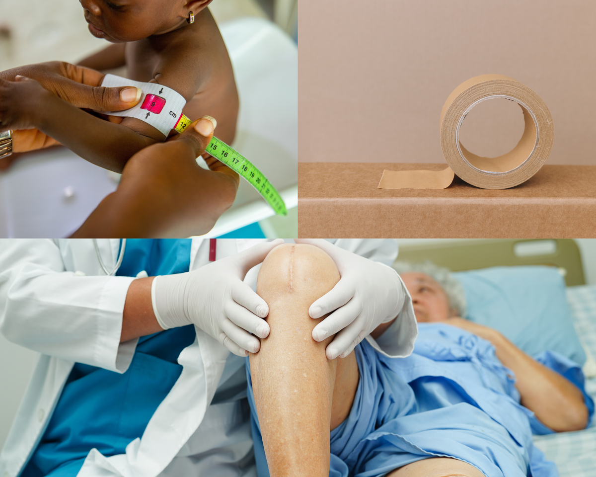 Scar Tape Options That Will Transform Your Skin: Say Goodbye to Scars!
