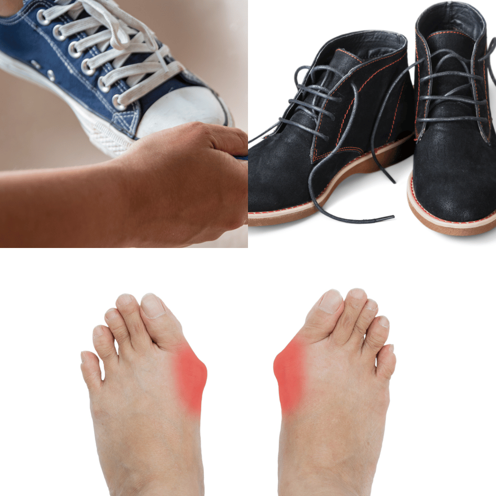 The Top Shoes for Hallux Rigidus